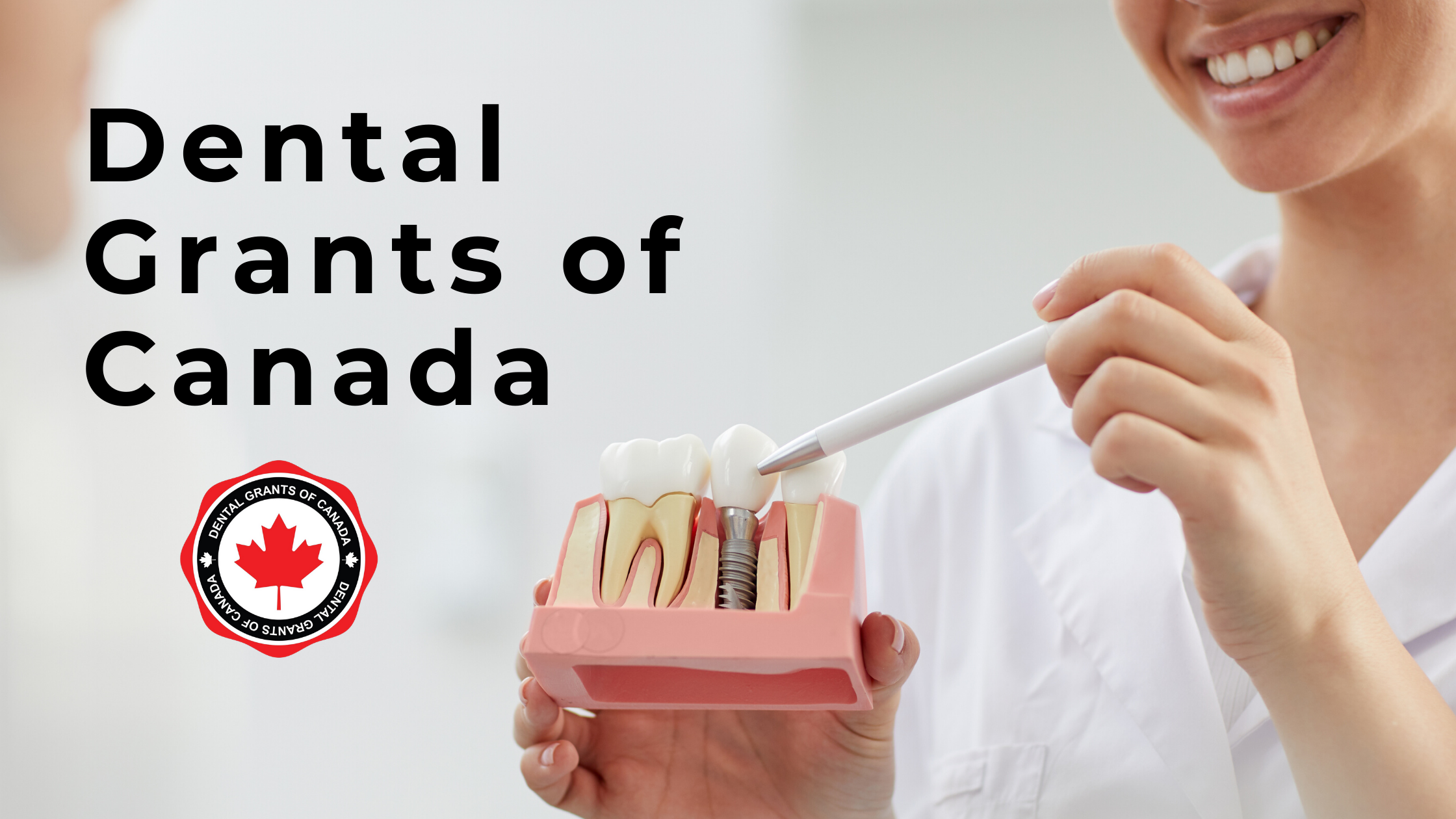 Dental Grants of Canada Dental Implants at Burlington
